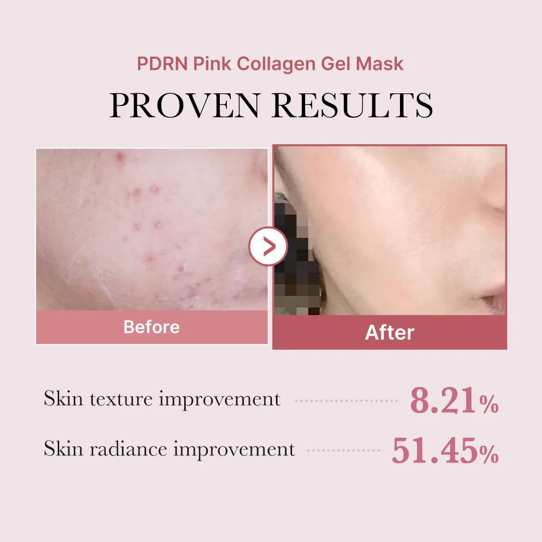 Medicube Pdrn Pink Gel Mask
