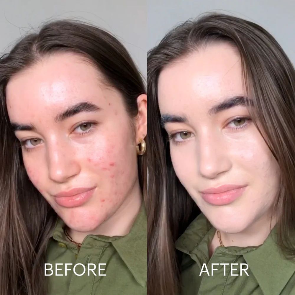 Dr. Jart Cicapair™ Tiger Grass Color Correcting Treatment SPF 30 - 15ml