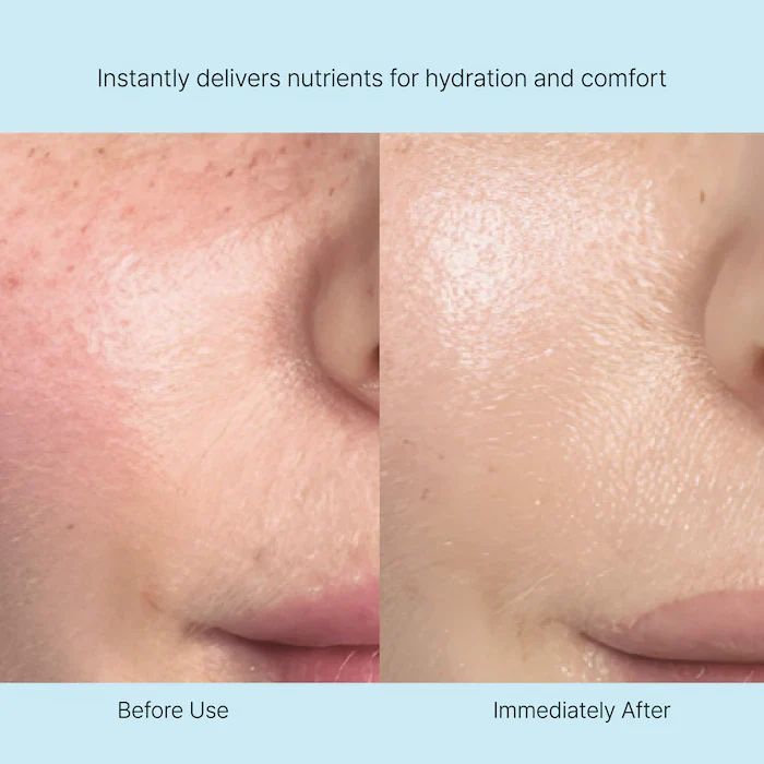 REJURAN Nutritive Cream - 50 ml